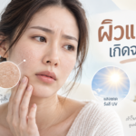 ผิวแห้งง่าย เกิดจากอะไร